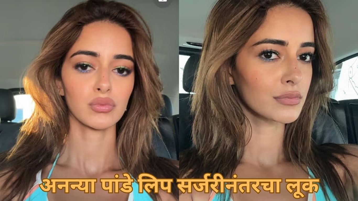 अनन्या पांडे लिप सर्जरीनंतरचा लूक