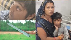 कार्बाइड गनचा कहर: लहान मुलांच्या डोळ्यांना सहानभूत जखमा, त्वरित उपाय गरजेचे