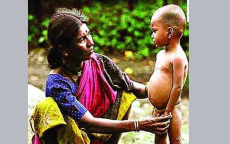 Maharashtra Malnutrition: राज्यात 1.37 लाख मुले कुपोषित; उच्च न्यायालयात राज्य सरकारची धक्कादायक कबुली