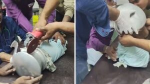 जळगावमध्ये थरारक बचावकार्य! भांड्यात अडकलेल्या चिमुकलीची डॉक्टर आणि प्लंबरच्या मदतीने 11 मिनिटांत सुरक्षित सुटका