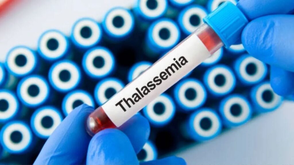 Thalassemia: ‘चाइल्ड हेल्प फाऊंडेशन’चे मोठे पाऊल बोन मॅरो ट्रान्सप्लांटसाठी विशेष केंद्राची स्थापना
