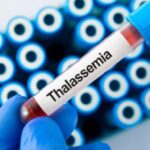 Thalassemia: ‘चाइल्ड हेल्प फाऊंडेशन’चे मोठे पाऊल बोन मॅरो ट्रान्सप्लांटसाठी विशेष केंद्राची स्थापना