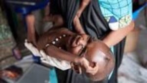 हवामान बदलाचा मातृ-बाल आरोग्यावर परिणाम; कुपोषण टाळण्यासाठी मातेच्या पोषणाला प्राधान्य गरजेचे